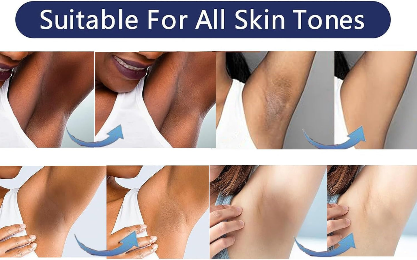 Gukei Intimate Areas Skin Lightening Cream Skin Bleaching Cream For Body Sensitive Intimate Area, Private Parts, Underarm, Knees, Elbows, Inner Thigh, Bikini Areas, Natural Skin Whitening Cream.