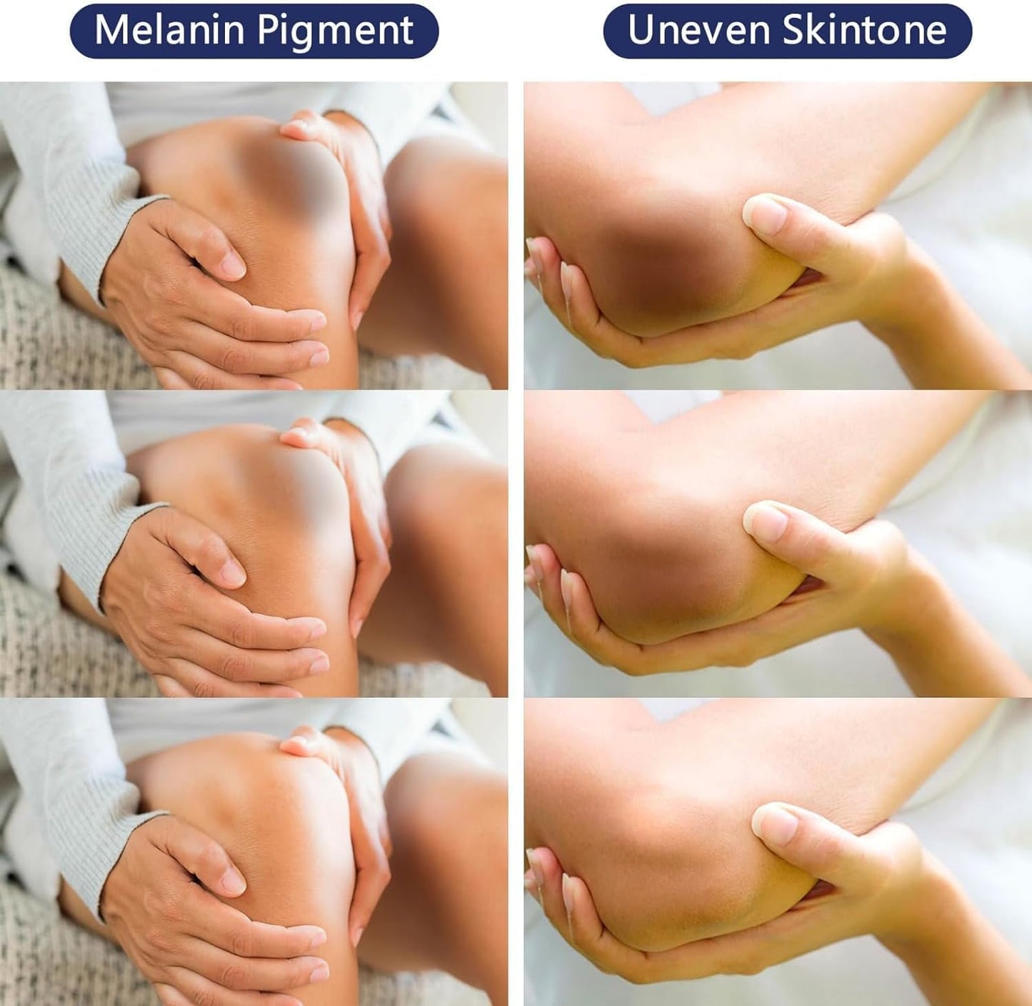 Gukei Intimate Areas Skin Lightening Cream Skin Bleaching Cream For Body Sensitive Intimate Area, Private Parts, Underarm, Knees, Elbows, Inner Thigh, Bikini Areas, Natural Skin Whitening Cream.