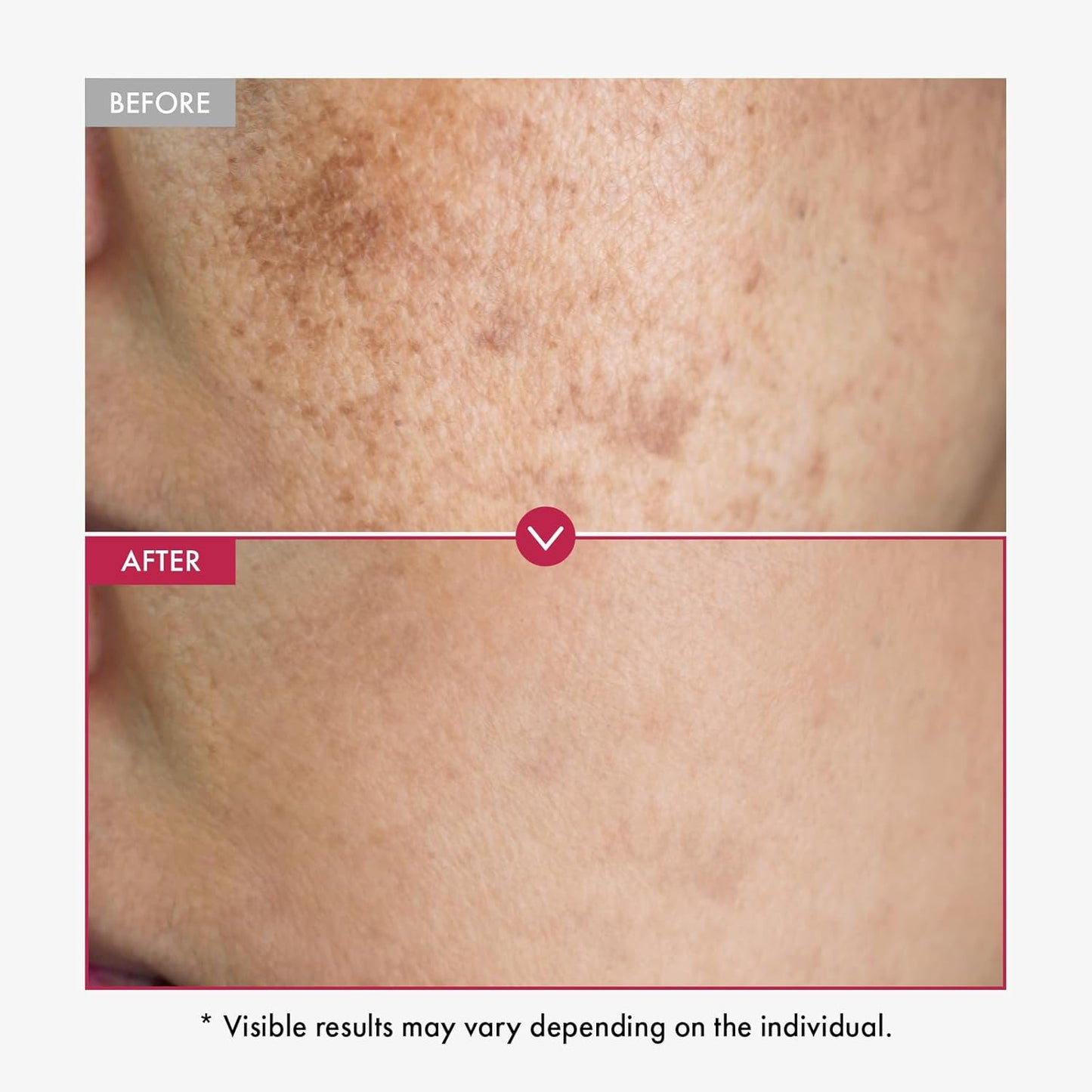 TOSOWOONG Niacinamide 10% + Tranexamic Acid 4% Serum with Arbutin and Hyaluronic Acid, Lightweight Daily Face Serum, Korean Skin Care, 33ml, 1.11 fl. oz