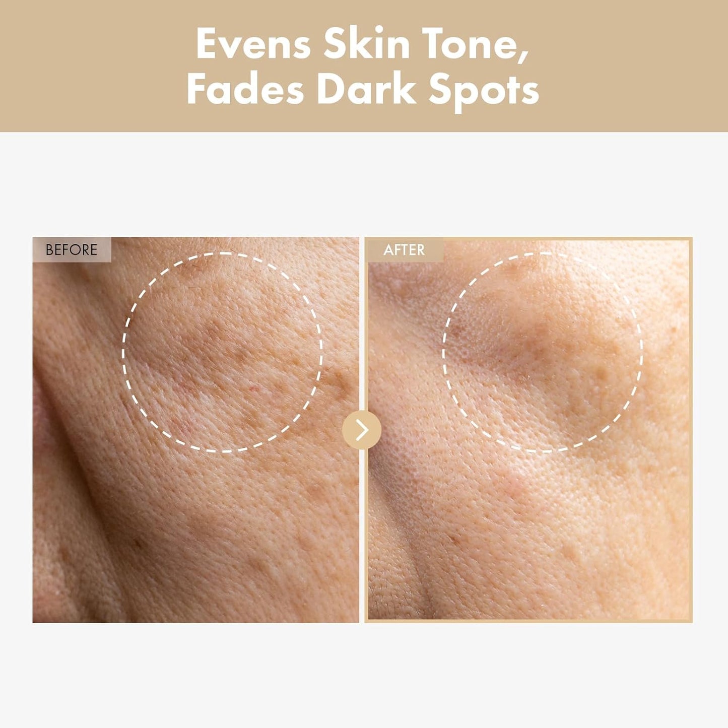 TOSOWOONG Rice Glow Milky Toner With 784,000ppm Korean Rice Water, Niacinamide, Ceramides, Panthenol, Glow, Glass Skin, Hydrating, Refreshing, Fragrance-Free, Korean Skin Care, 250ml, 8.45 fl.oz