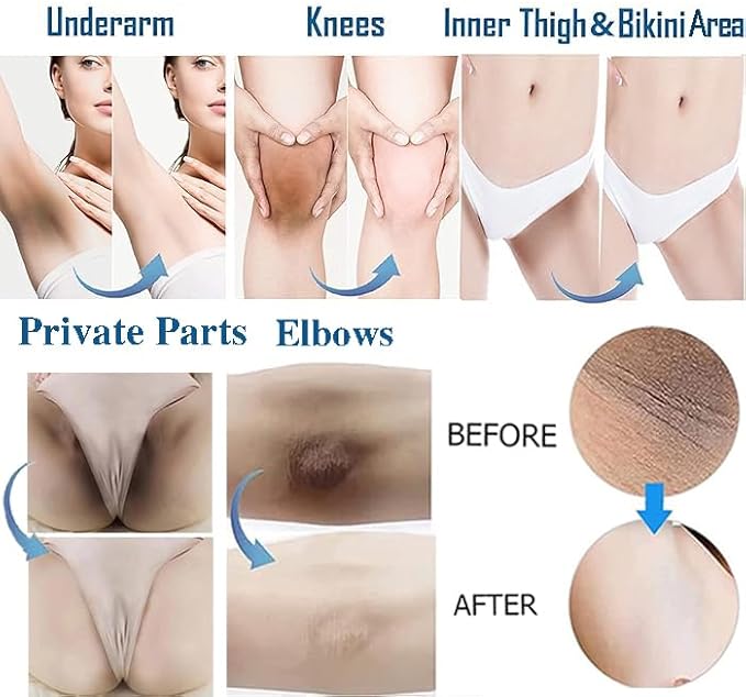 Gukei Intimate Areas Skin Lightening Cream Skin Bleaching Cream For Body Sensitive Intimate Area, Private Parts, Underarm, Knees, Elbows, Inner Thigh, Bikini Areas, Natural Skin Whitening Cream.