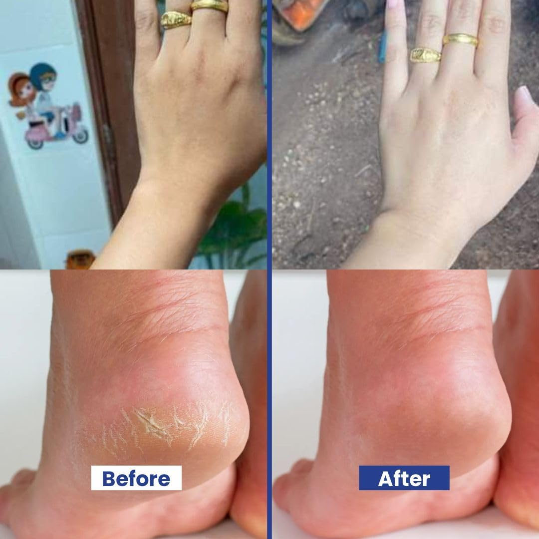 BIOCOS Hand & Feet Scrub with Vitamin E, Olive Oil & Jojoba Oil – Deeply Hydrates, Restore Dry Skin, Treats Cracked Heels, Exfoliates & Moisturizes for Smooth, Healthy Hands & Feet