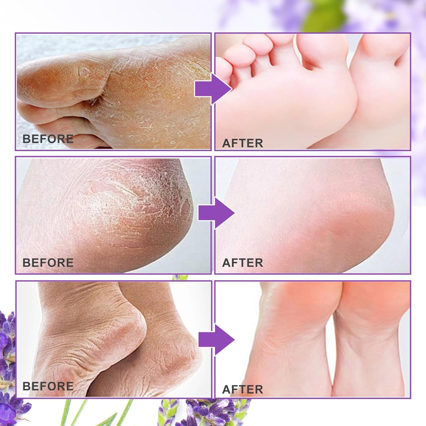 ALIVER Foot Peel Women Exfoliator Peel Off Calluses Dead Skin Mask, Pack of 3 (Lavender)