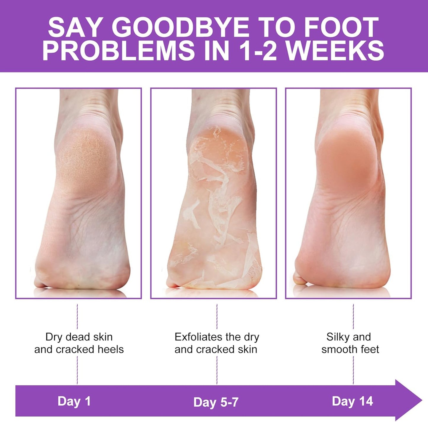 ALIVER Foot Peel Women Exfoliator Peel Off Calluses Dead Skin Mask, Pack of 3 (Lavender)