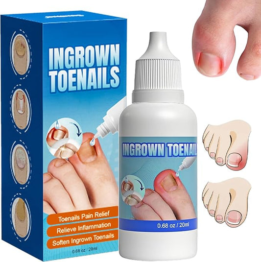 Ingrown Toenail Care Kit, Extra Strong Fungal Solution & Professional Removal Tool for Thick Toenails
